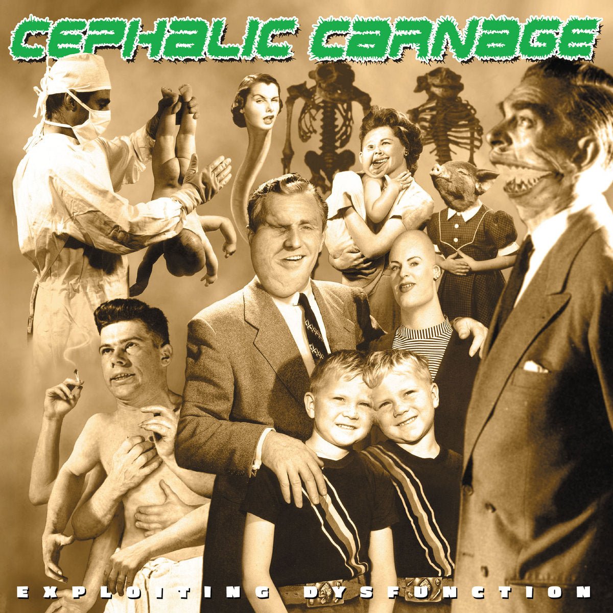 CEPHALIC CARNAGE "Exploiting Dysfunction (Deluxe 25th Anniversary Reissue)" 2xLP
